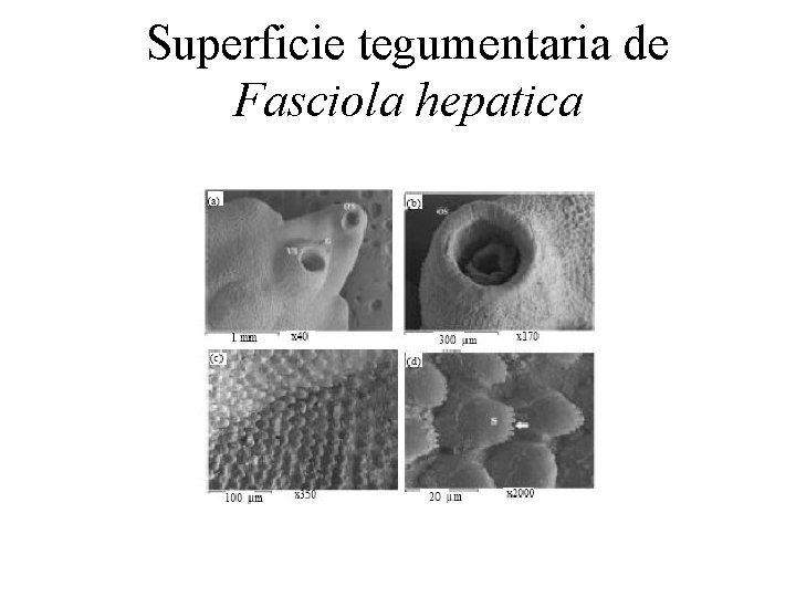 Superficie tegumentaria de Fasciola hepatica 