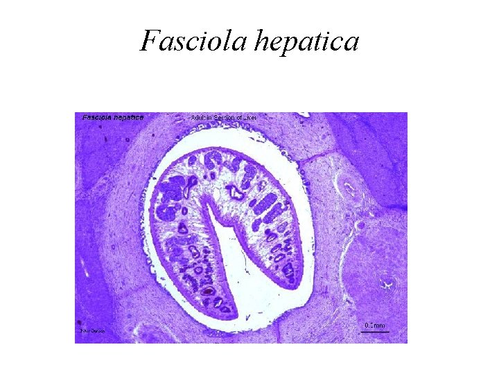 Fasciola hepatica 