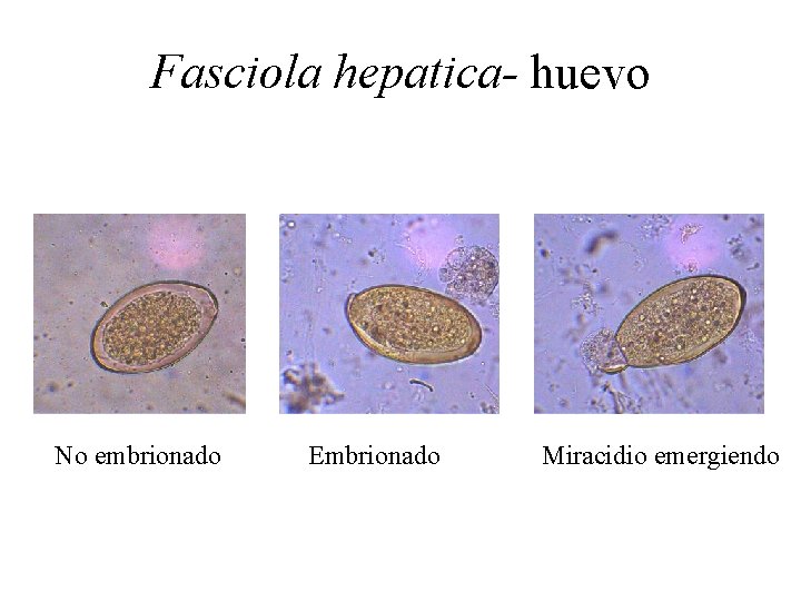 Fasciola hepatica- huevo No embrionado Embrionado Miracidio emergiendo 