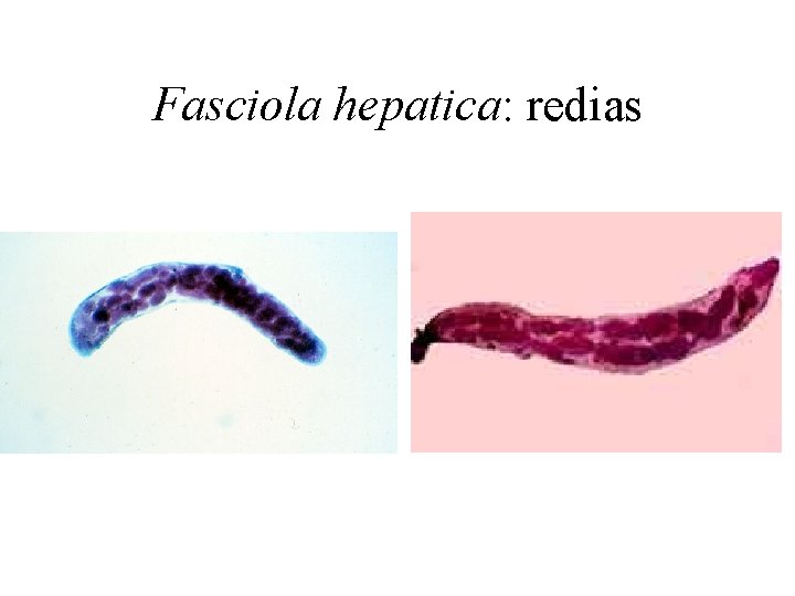 Fasciola hepatica: redias 