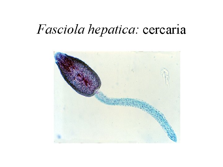 Fasciola hepatica: cercaria 