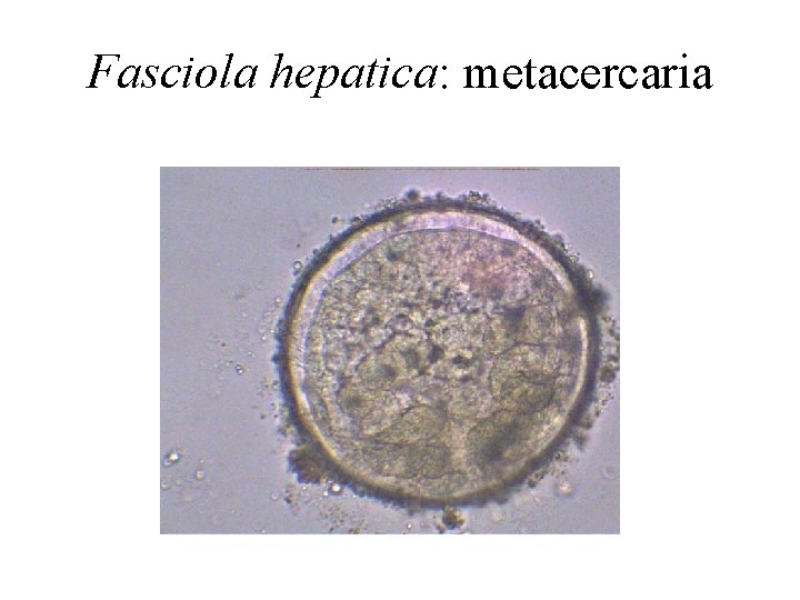 Fasciola hepatica: metacercaria 