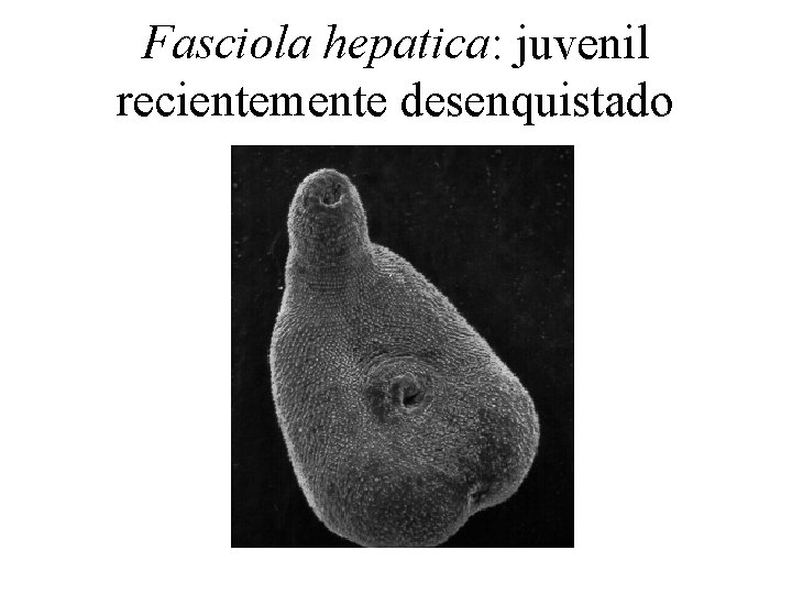 Fasciola hepatica: juvenil recientemente desenquistado 