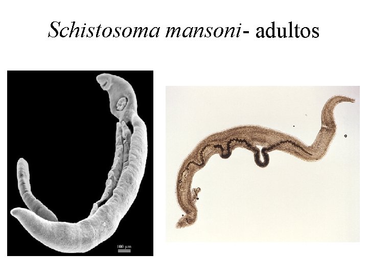 Schistosoma mansoni- adultos 