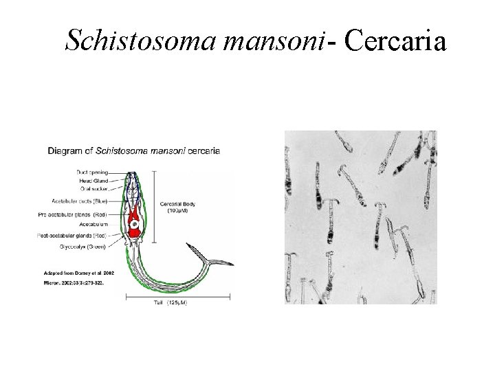 Schistosoma mansoni- Cercaria 