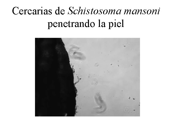 Cercarias de Schistosoma mansoni penetrando la piel 