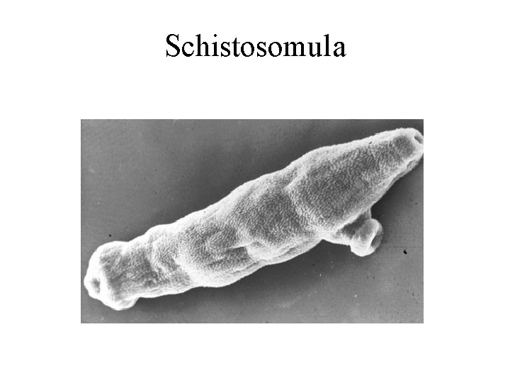 Schistosomula 