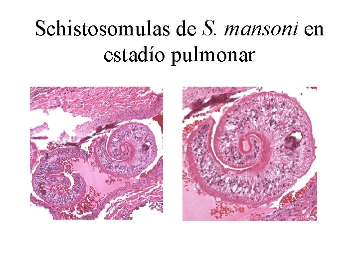 Schistosomulas de S. mansoni en estadío pulmonar 