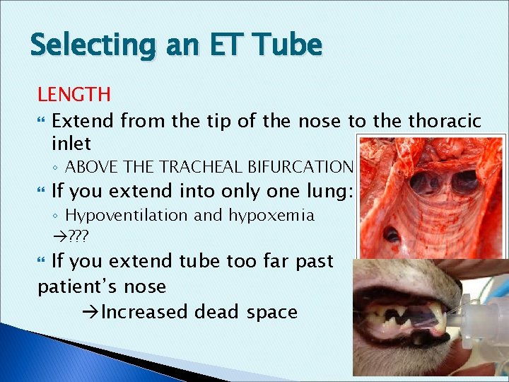 Selecting an ET Tube LENGTH Extend from the tip of the nose to the