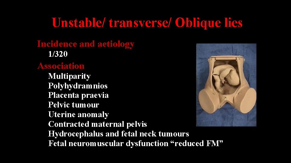 Unstable/ transverse/ Oblique lies Incidence and aetiology 1/320 Association Multiparity Polyhydramnios Placenta praevia Pelvic