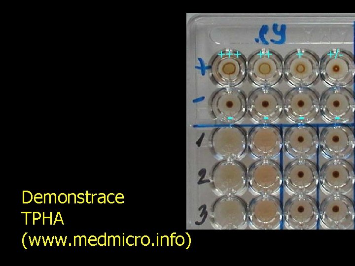 Demonstrace TPHA (www. medmicro. info) +++ ++ + +/- - - 