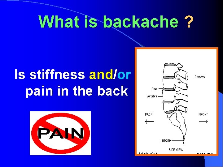 What is backache ? Is stiffness and/or pain in the back 