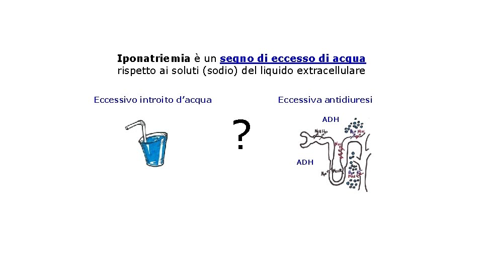 Iponatriemia è un segno di eccesso di acqua rispetto ai soluti (sodio) del liquido
