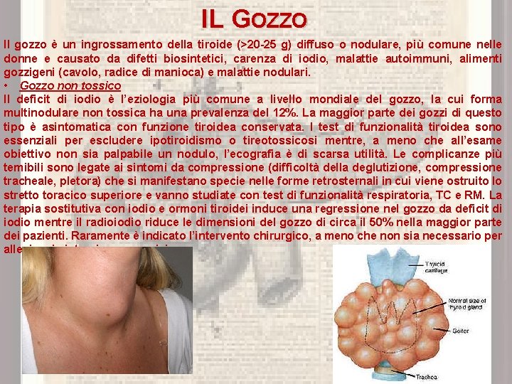 IL GOZZO Il gozzo è un ingrossamento della tiroide (>20 -25 g) diffuso o