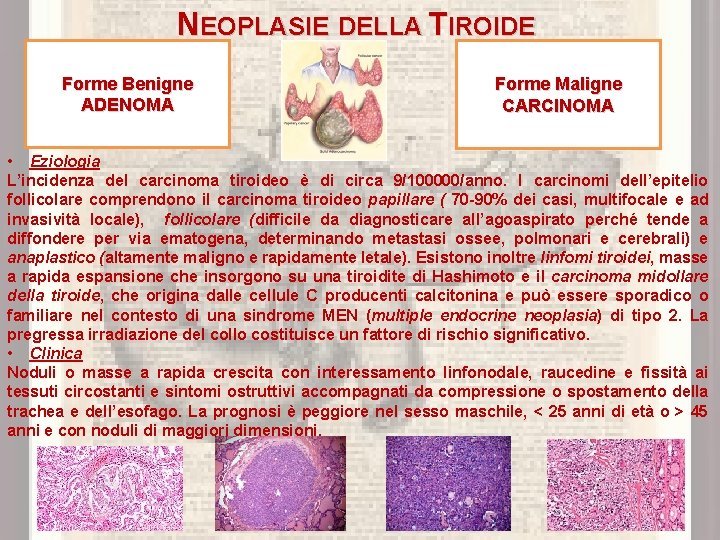 NEOPLASIE DELLA TIROIDE Forme Benigne ADENOMA Forme Maligne CARCINOMA • Eziologia L’incidenza del carcinoma