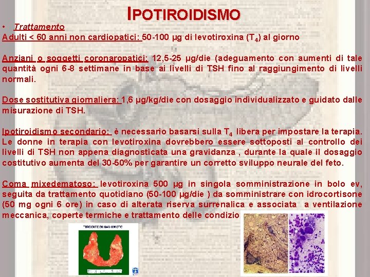 IPOTIROIDISMO • Trattamento Adulti < 60 anni non cardiopatici: 50 -100 µg di levotiroxina