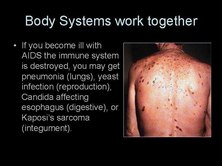 Body Systems work together • If you become ill with AIDS the immune system