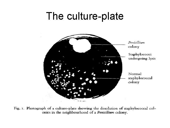 The culture-plate 