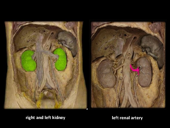 right and left kidney left renal artery 