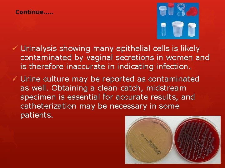 Continue…. . ü Urinalysis showing many epithelial cells is likely contaminated by vaginal secretions