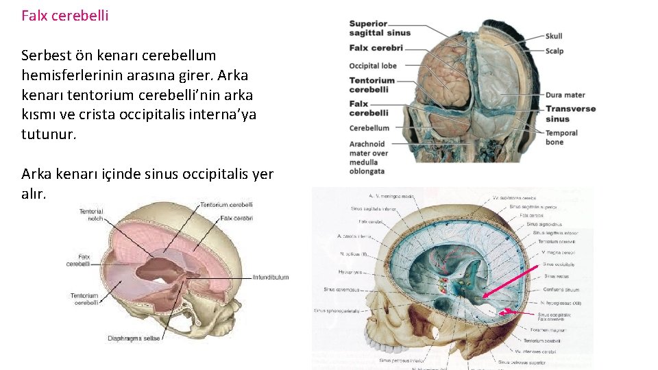 Falx cerebelli Serbest ön kenarı cerebellum hemisferlerinin arasına girer. Arka kenarı tentorium cerebelli’nin arka