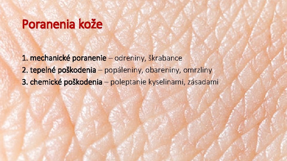 Poranenia kože 1. mechanické poranenie – odreniny, škrabance 2. tepelné poškodenia – popáleniny, obareniny,