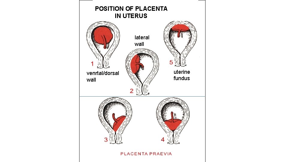 POSITION OF PLACENTA IN UTERUS lateral wall venrtal/dorsal wall uterine fundus 