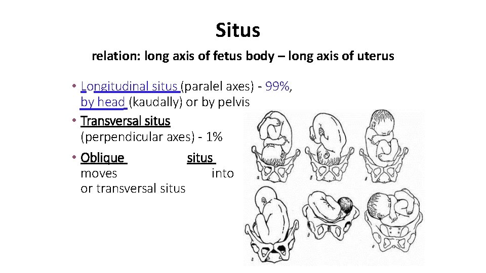 Situs relation: long axis of fetus body – long axis of uterus • Longitudinal