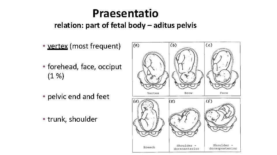 Praesentatio relation: part of fetal body – aditus pelvis • vertex (most frequent) •