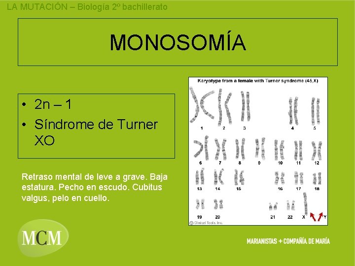 LA MUTACIÓN – Biología 2º bachillerato MONOSOMÍA • 2 n – 1 • Síndrome