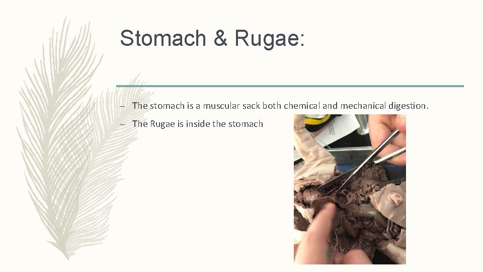 Stomach & Rugae: – The stomach is a muscular sack both chemical and mechanical