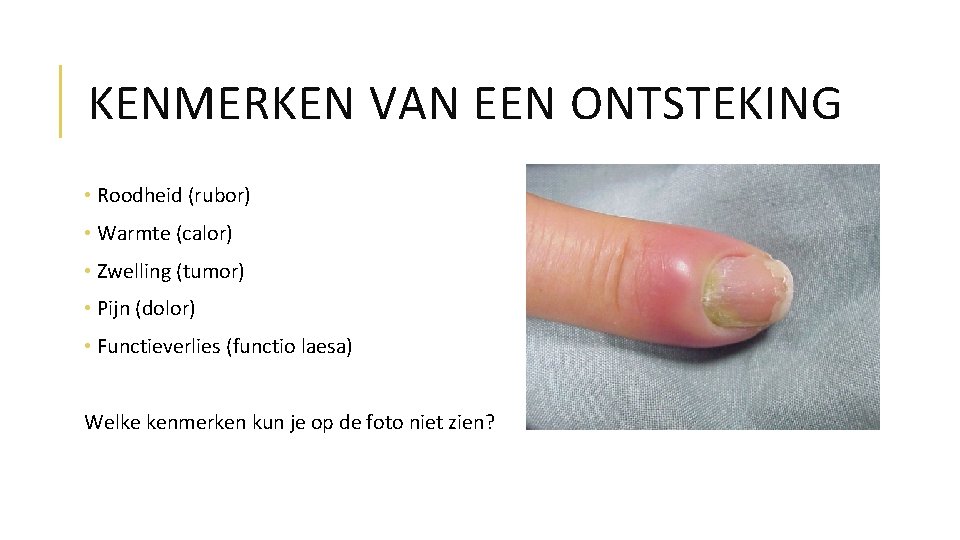 KENMERKEN VAN EEN ONTSTEKING • Roodheid (rubor) • Warmte (calor) • Zwelling (tumor) •