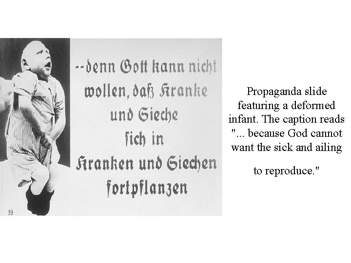 Propaganda slide featuring a deformed infant. The caption reads ". . . because God