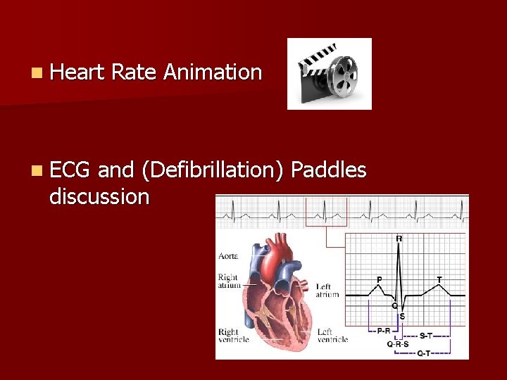 n Heart n ECG Rate Animation and (Defibrillation) Paddles discussion 