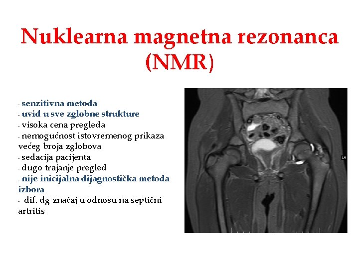 Nuklearna magnetna rezonanca (NMR) senzitivna metoda - uvid u sve zglobne strukture - visoka