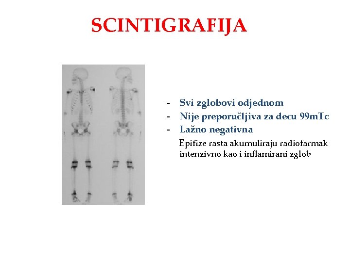 SCINTIGRAFIJA - Svi zglobovi odjednom - Nije preporučljiva za decu 99 m. Tc -