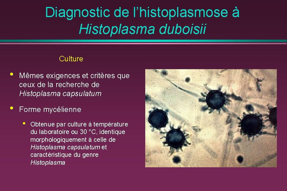 Diagnostic de l’histoplasmose à Histoplasma duboisii Culture • Mêmes exigences et critères que ceux