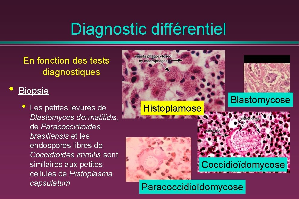 Diagnostic différentiel En fonction des tests diagnostiques • Biopsie • Les petites levures de