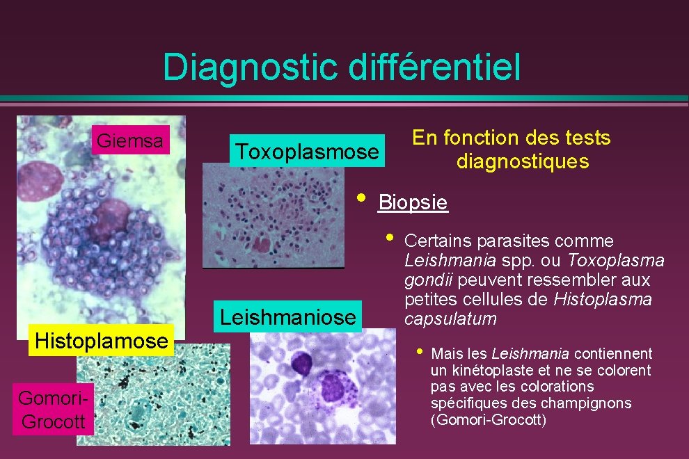 Diagnostic différentiel Giemsa En fonction des tests diagnostiques Toxoplasmose • Biopsie • Histoplamose Gomori.