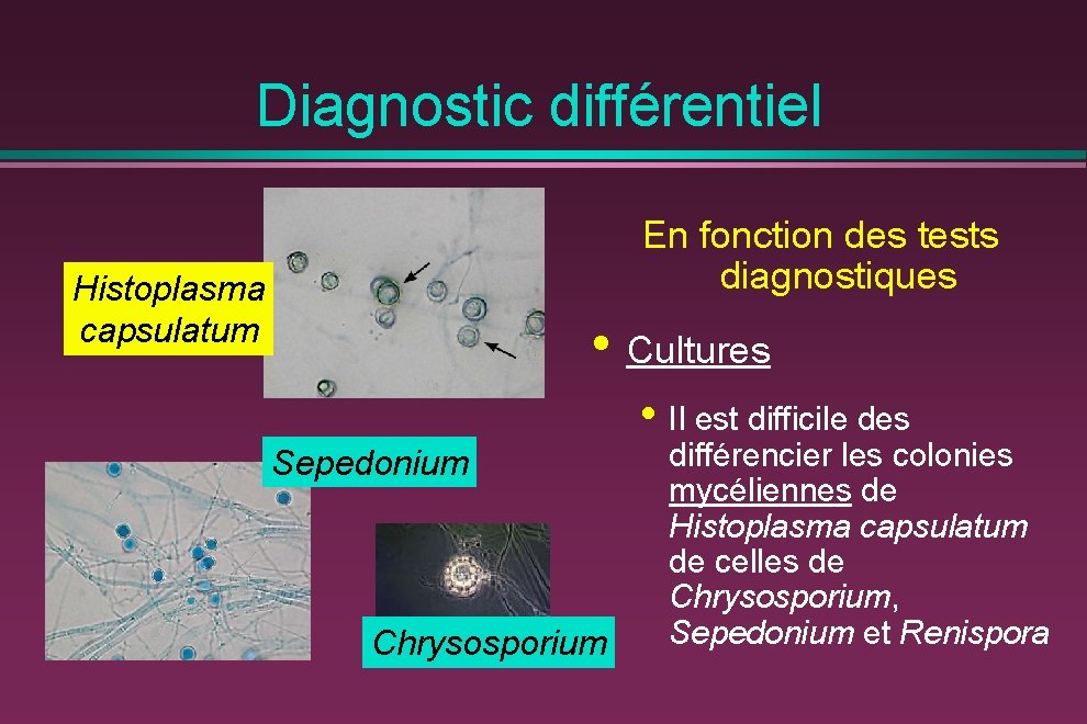 Diagnostic différentiel En fonction des tests diagnostiques Histoplasma capsulatum • Cultures • Il est