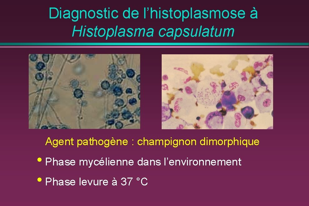 Diagnostic de l’histoplasmose à Histoplasma capsulatum Agent pathogène : champignon dimorphique • Phase mycélienne