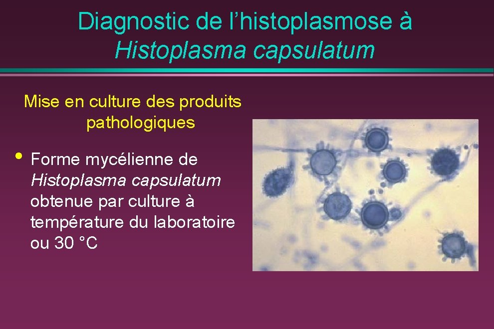 Diagnostic de l’histoplasmose à Histoplasma capsulatum Mise en culture des produits pathologiques • Forme