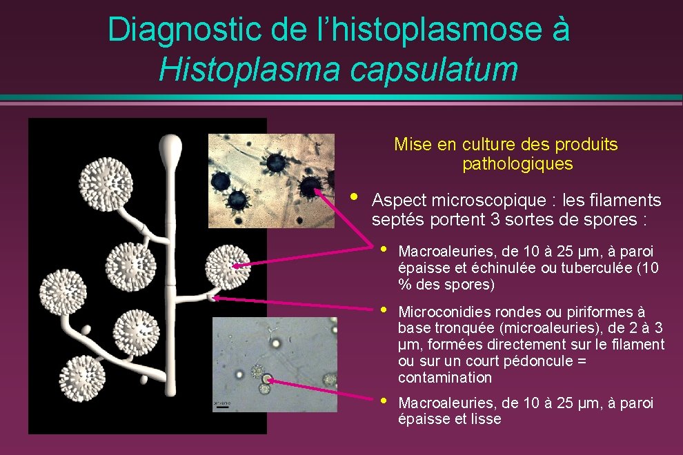 Diagnostic de l’histoplasmose à Histoplasma capsulatum Mise en culture des produits pathologiques • Aspect