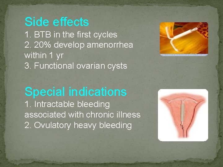 Side effects 1. BTB in the first cycles 2. 20% develop amenorrhea within 1