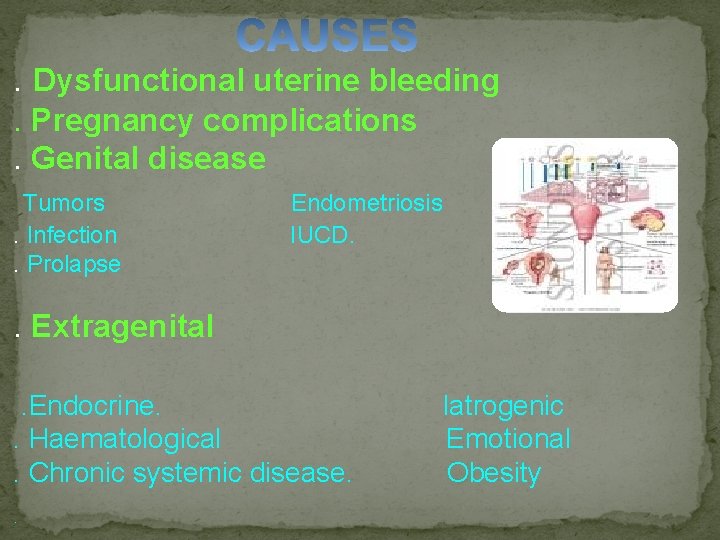 . Dysfunctional uterine bleeding. Pregnancy complications. Genital disease Tumors. Infection. Prolapse Endometriosis IUCD. .