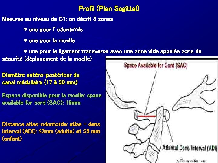 Profil (Plan Sagittal) Mesures au niveau de C 1: on décrit 3 zones * Profil (Plan Sagittal) Mesures au niveau de C 1: on décrit 3 zones *