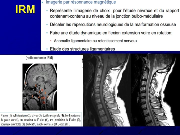 IRM 