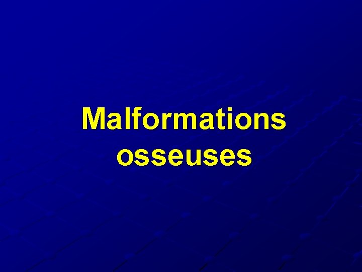 Malformations osseuses Malformations osseuses