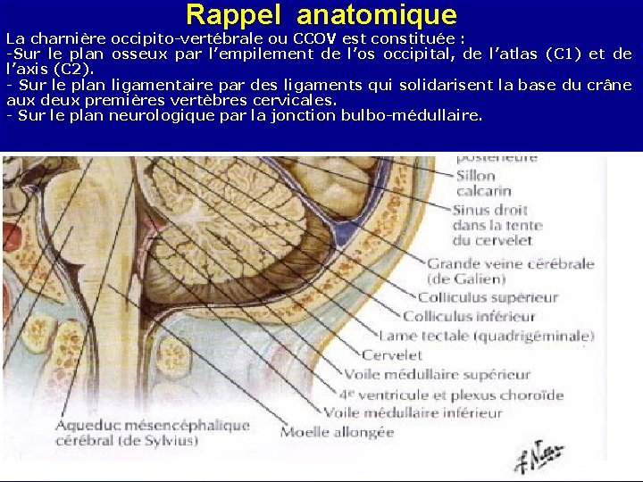 Rappel anatomique La charnière occipito-vertébrale ou CCOV est constituée : -Sur le plan osseux