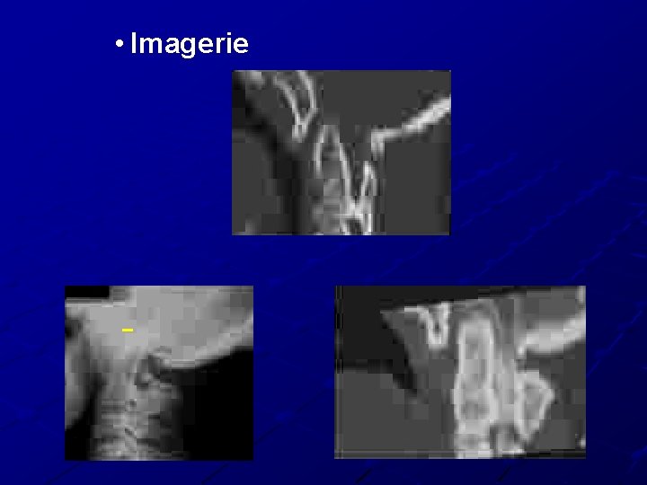 • Imagerie • Imagerie